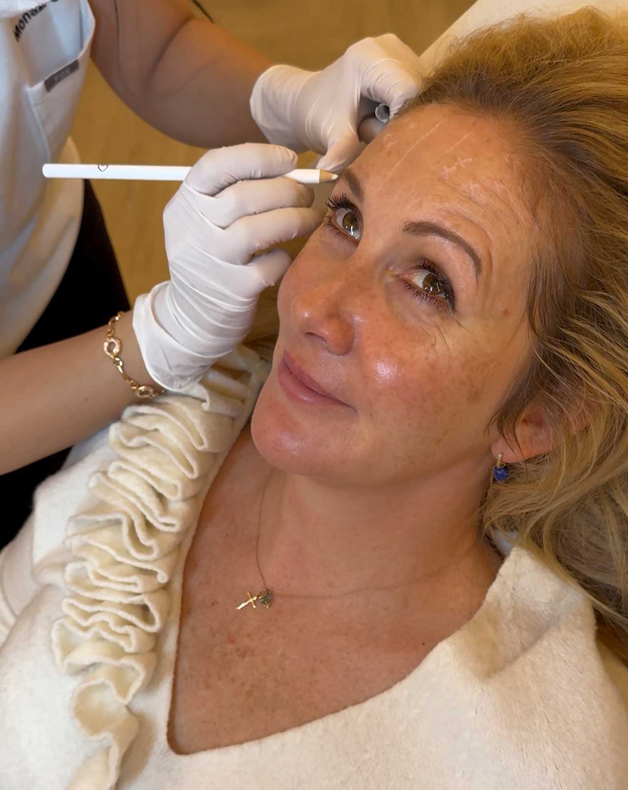 how anti wrinkle treatment works forehead lines