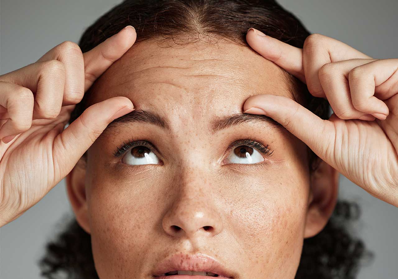 Forehead Lines 1 forehead lines on face