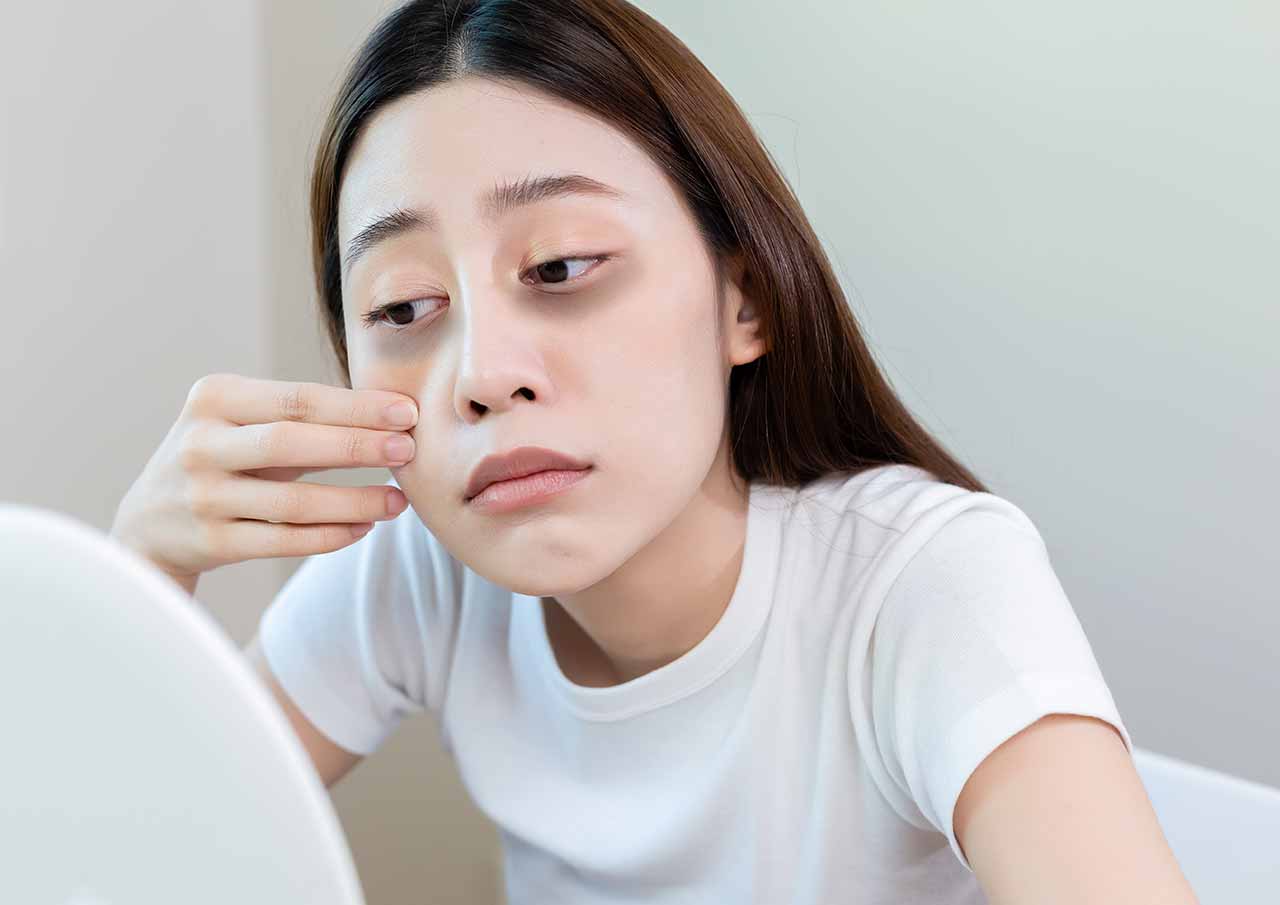 Tear Trough Treatment (Under-Eye Hollows) 1 Are-Under-Eye-Hollows-Making-You-Look-Tired-or-Aged