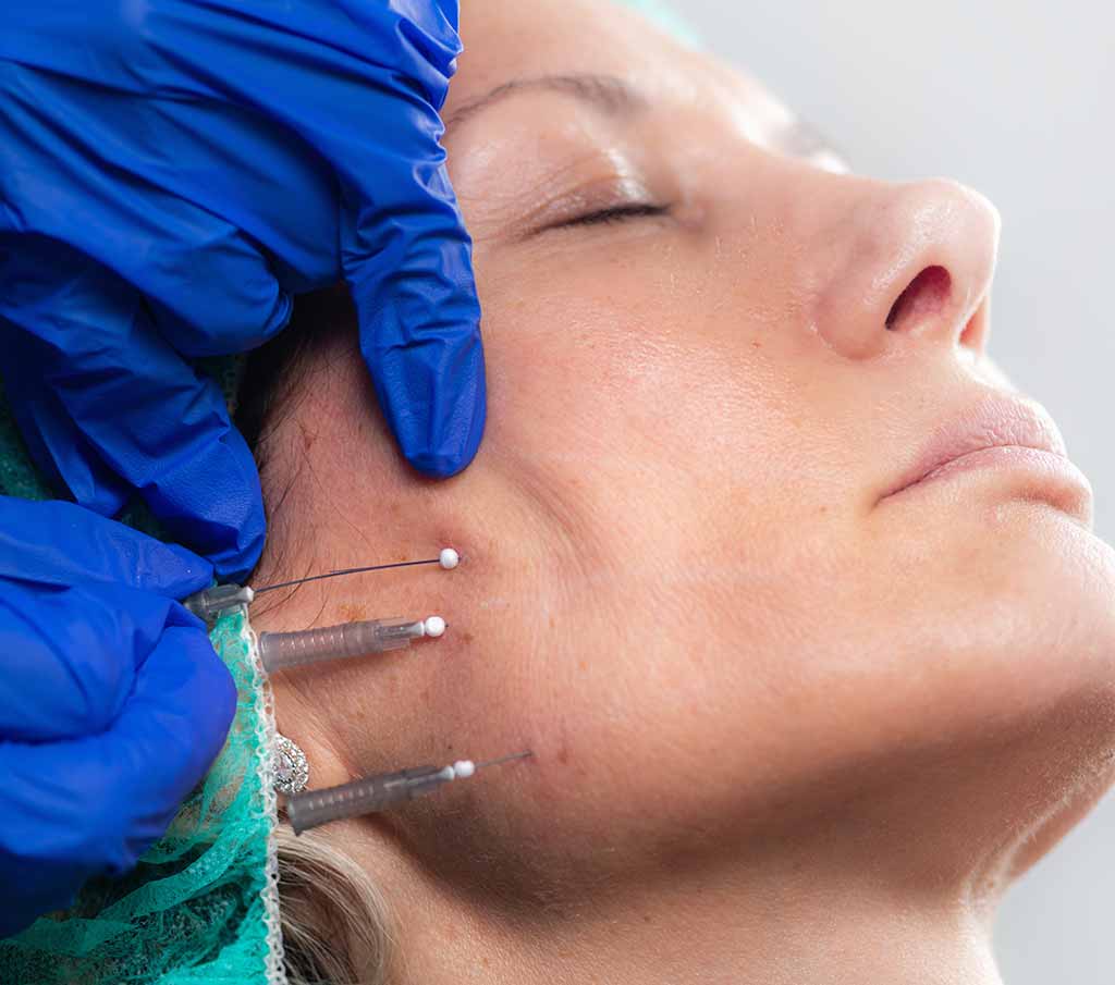 Home 36 Bruxism Treatment (Teeth Grinding and Jaw Clenching)