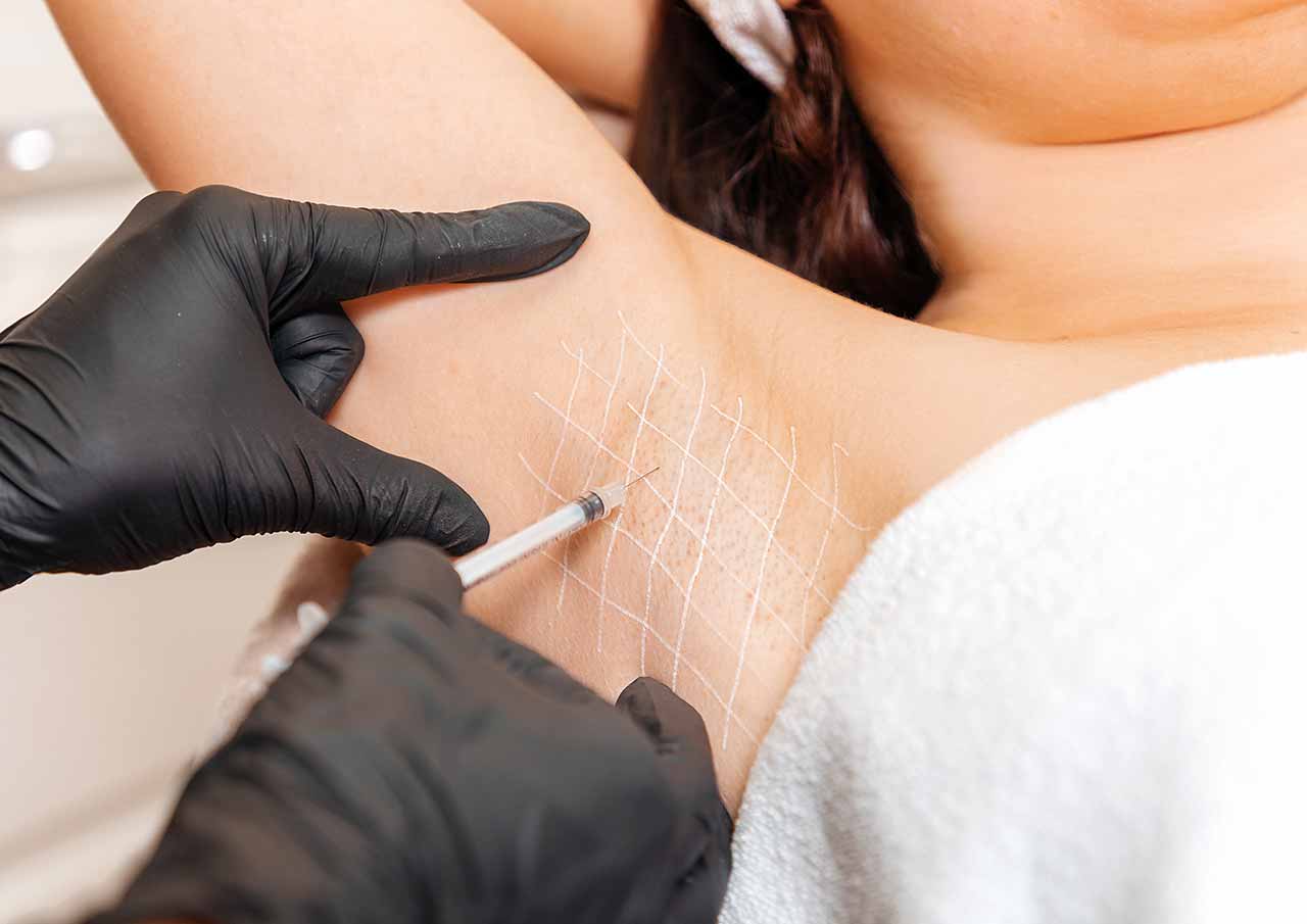 Hyperhidrosis Treatment Excessive Sweating 3 Monaz-Clinic-hyperhidrosis-treatment-process