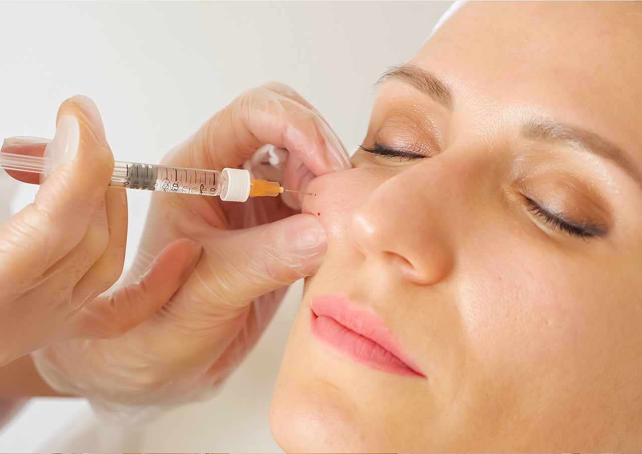 Cheek Enhancement 3 Monaz-clinic-Why-We-Use-These-Brands-for-cheek-Enhancement