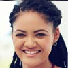 Gummy Smile Correction 8 Testimonials 19