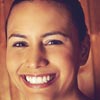 Frown Lines (Glabellar Lines) 8 Testimonials 22