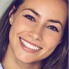Brow Lift 7 Testimonials 34
