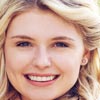 Crow's Feet (Periorbital Lines) 10 Testimonials 37