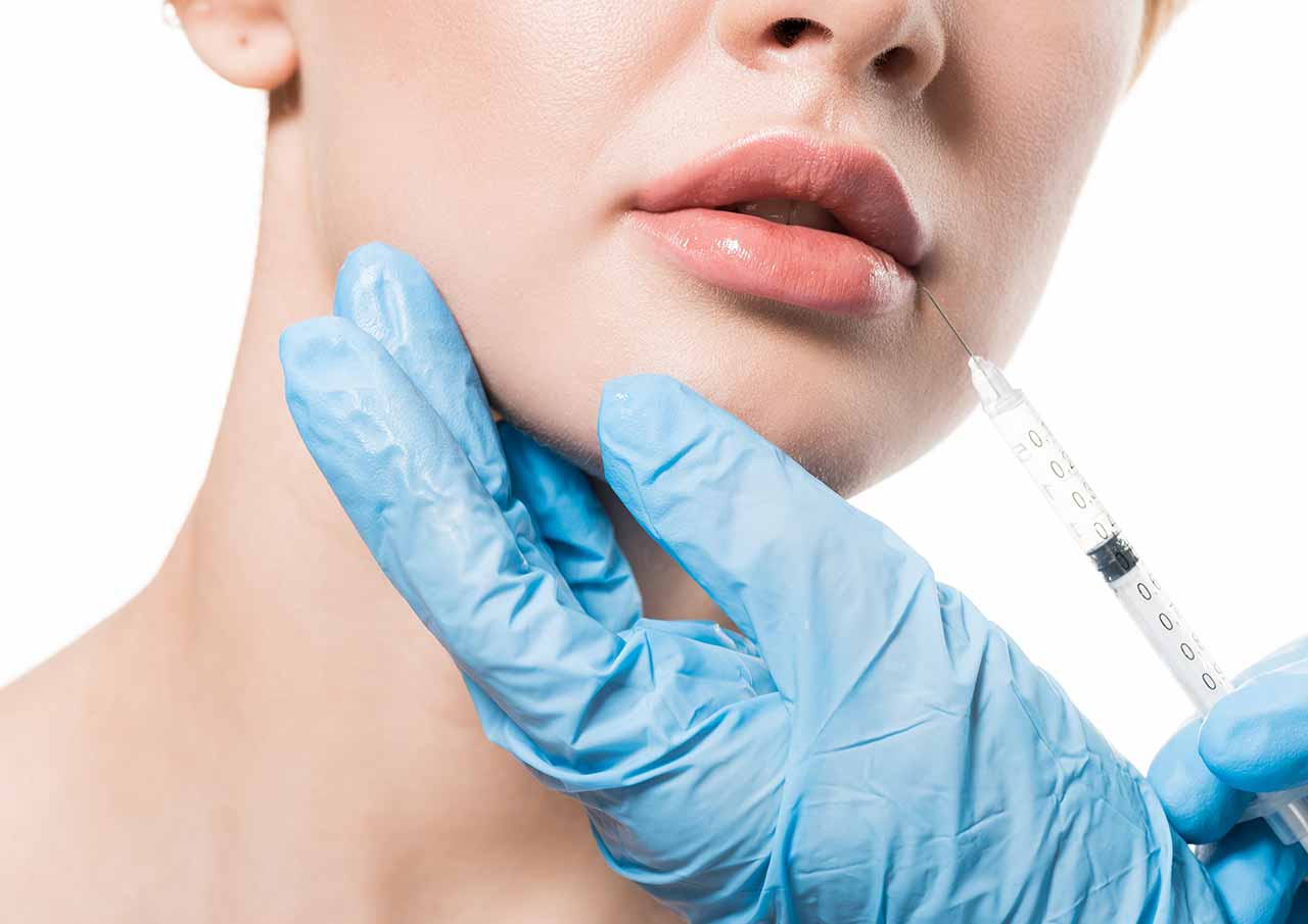 Marionette Lines 2 Why Choose Dermal Fillers for Downturned Mouth Corners