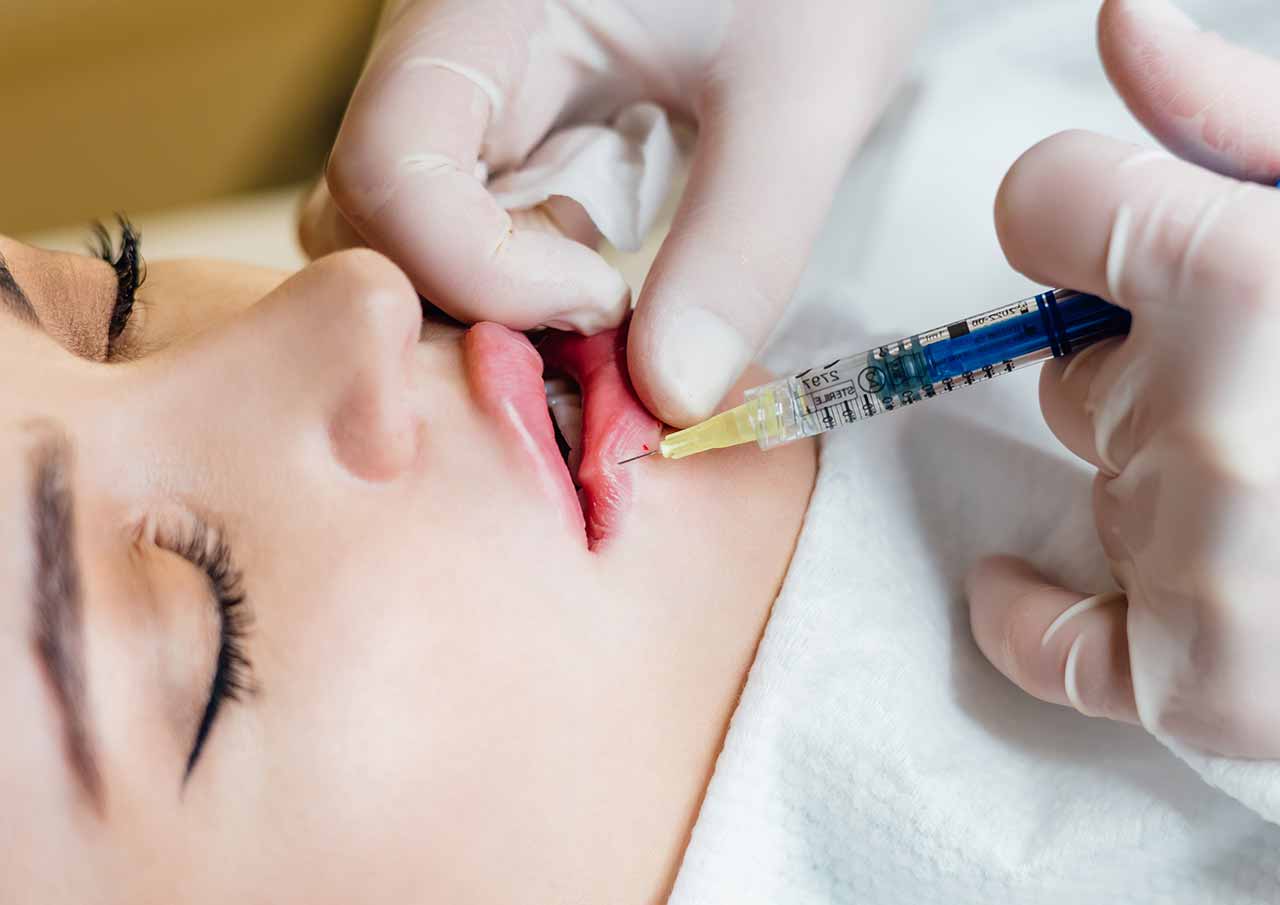 Lip Enhancement 2 Why-Choose-Dermal-Fillers-for-Lip-Enhancement