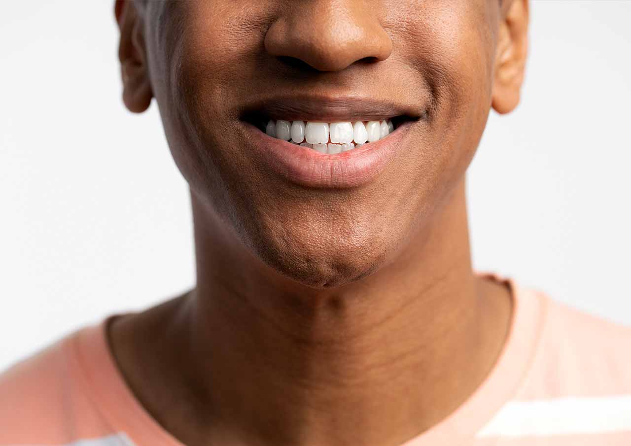 Chin Dimples and Pebbling 1 chin-dimples-treatment