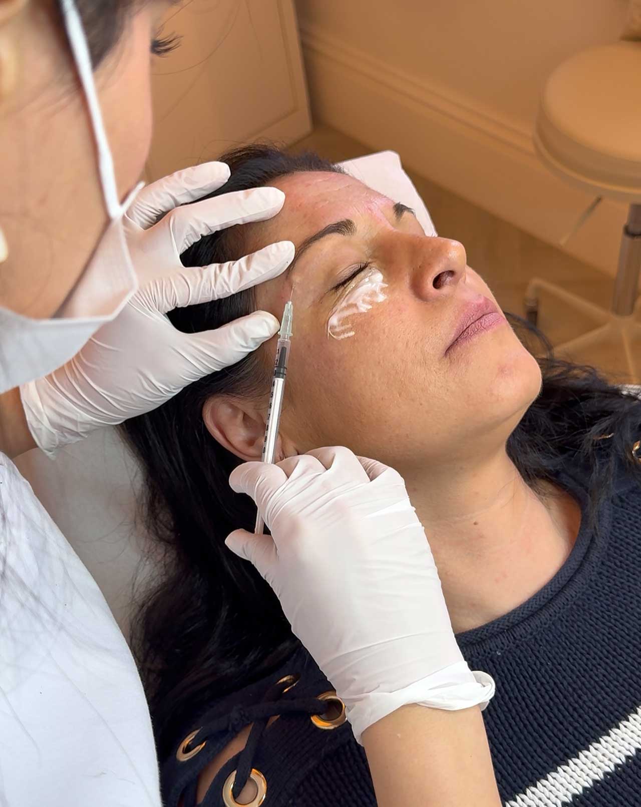 Brow Lift 3 how anti wrinkle injections work monaz clinic