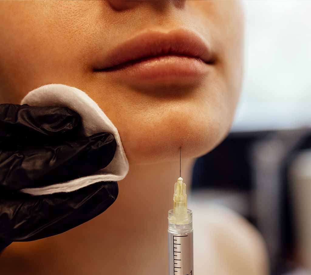 Chin Dimples and Pebbling 3 how does chin bimples treatment work