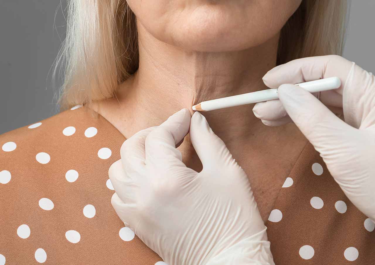 Nefertiti Neck Lift 3 how is Nefertiti Neck Lift treatment works