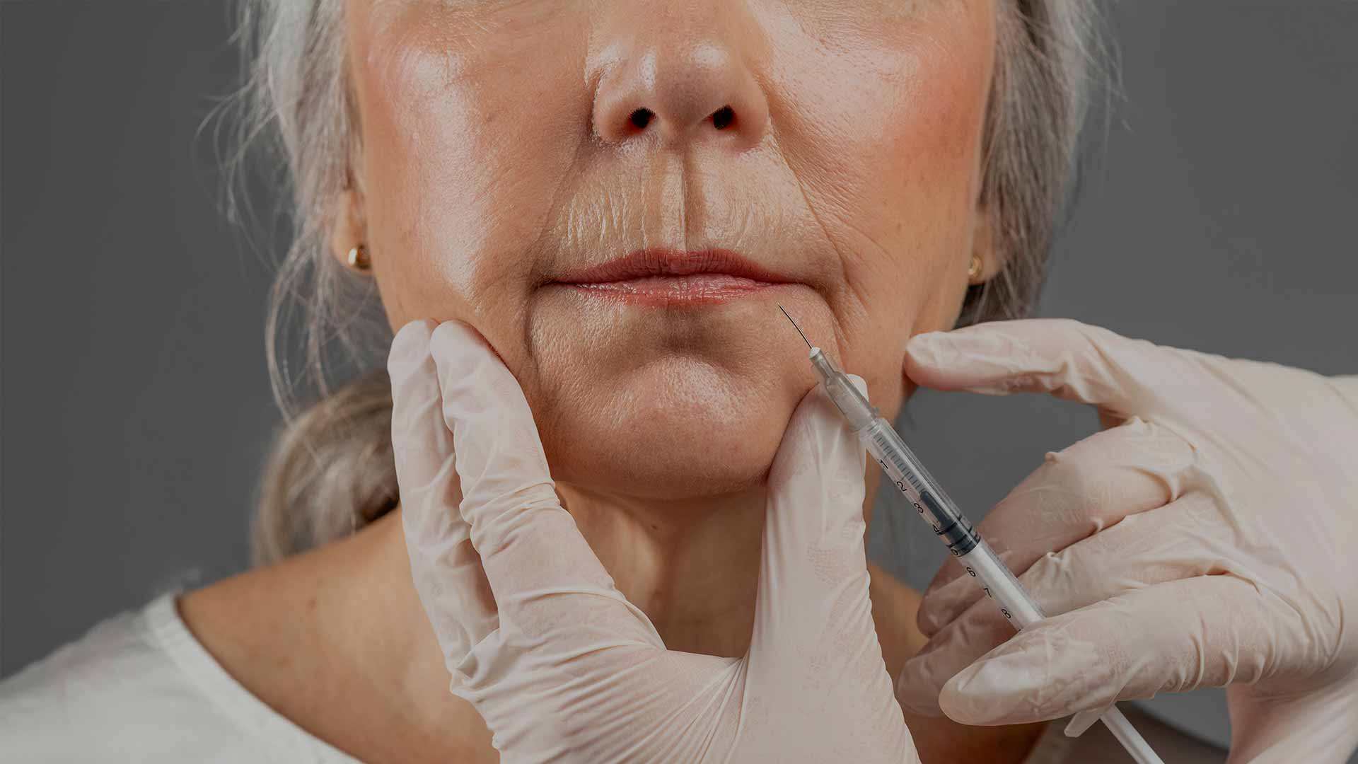 monaz-clinic-smokers-lines