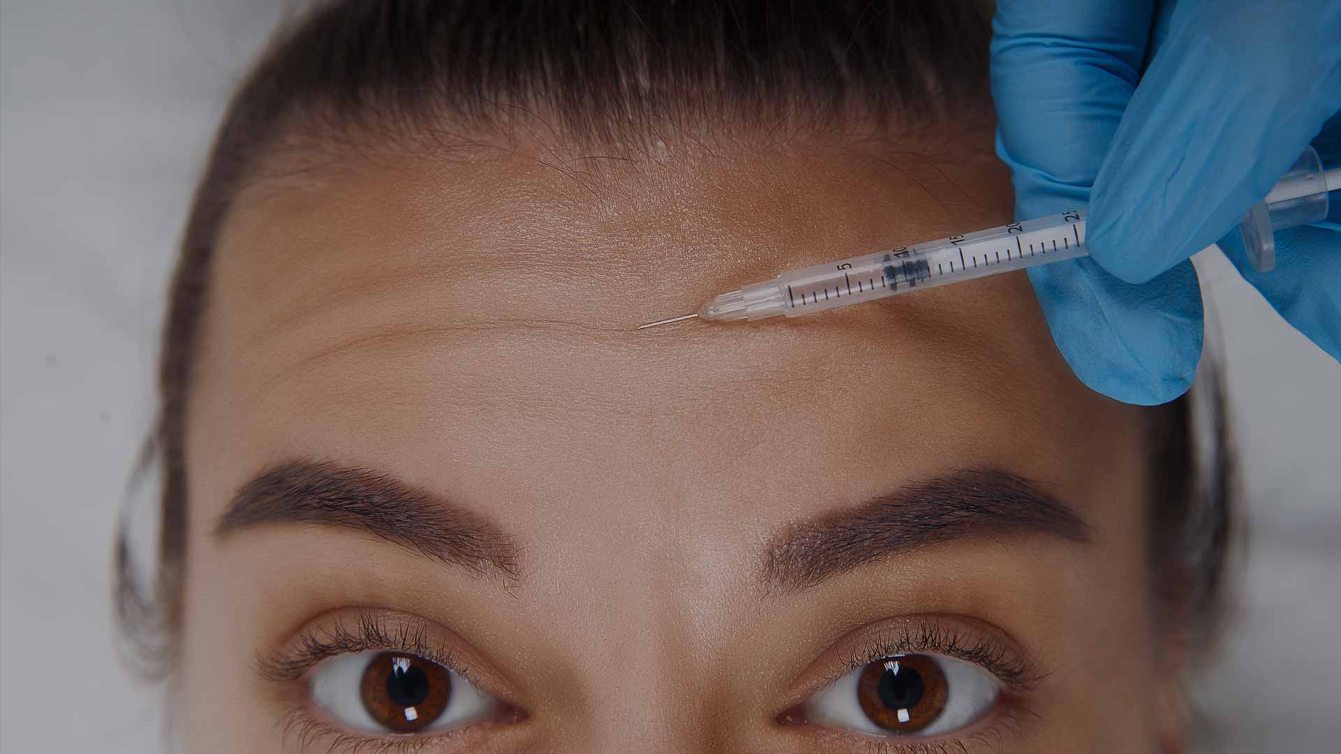 monaz-header-forehead-lines