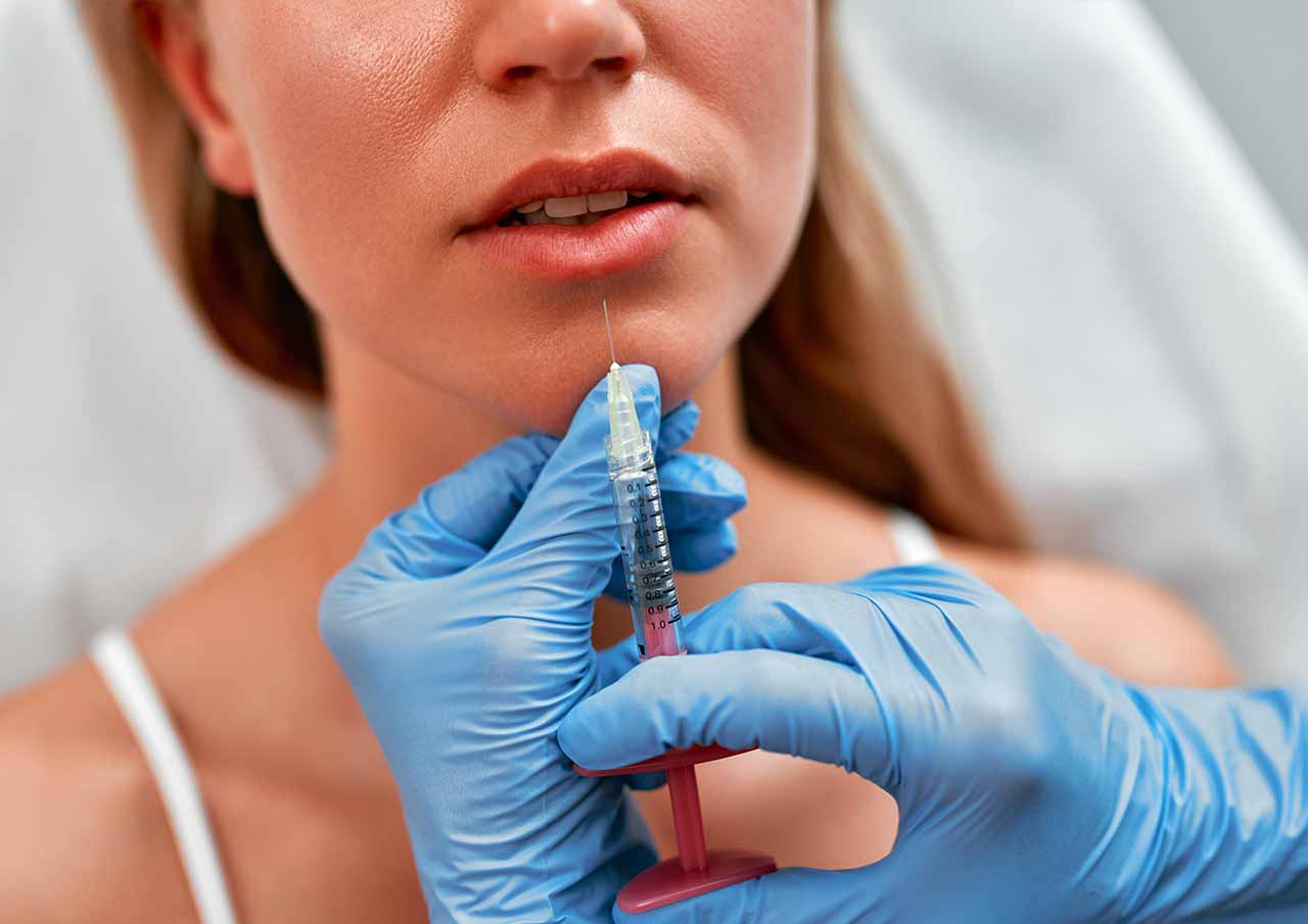 Smokers' Lines (Perioral Lines) 2 what is smokers lines treatment for