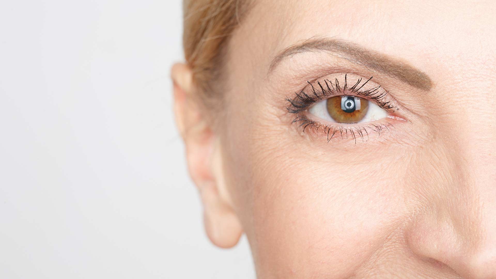 Treatment Packages 3 monaz-clinic-Radiant-Eyes-Package