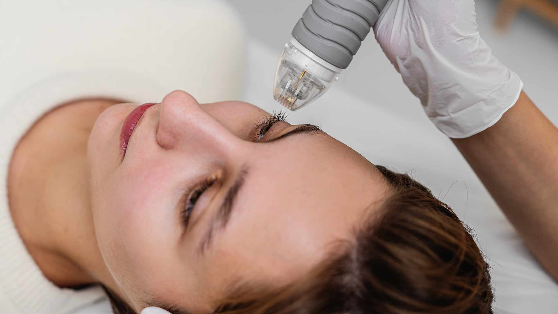 Dermapen-Anti-Ageing-Treatment-monaz-clinic