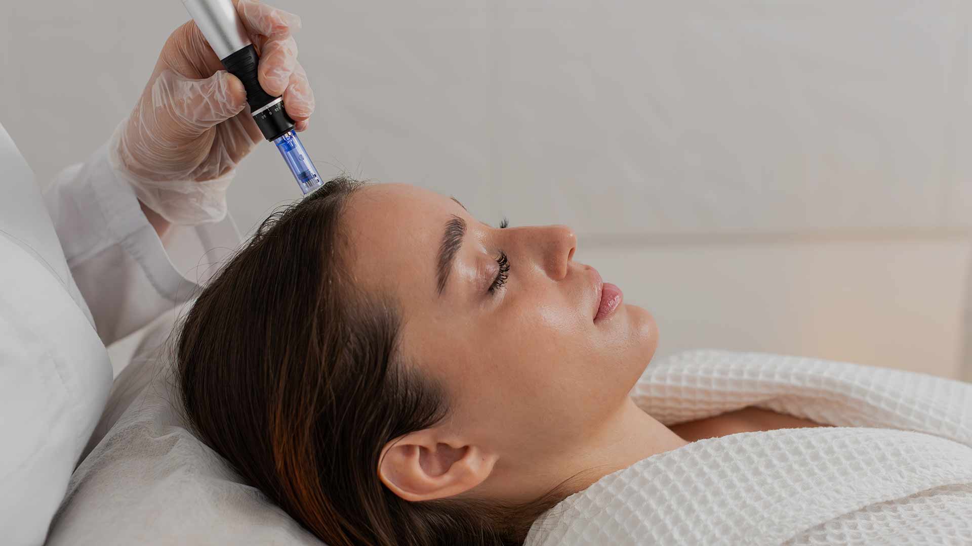 Dermapen-+-Exosome-Treatment-for-Hair-and-Scalp-Rejuvenation