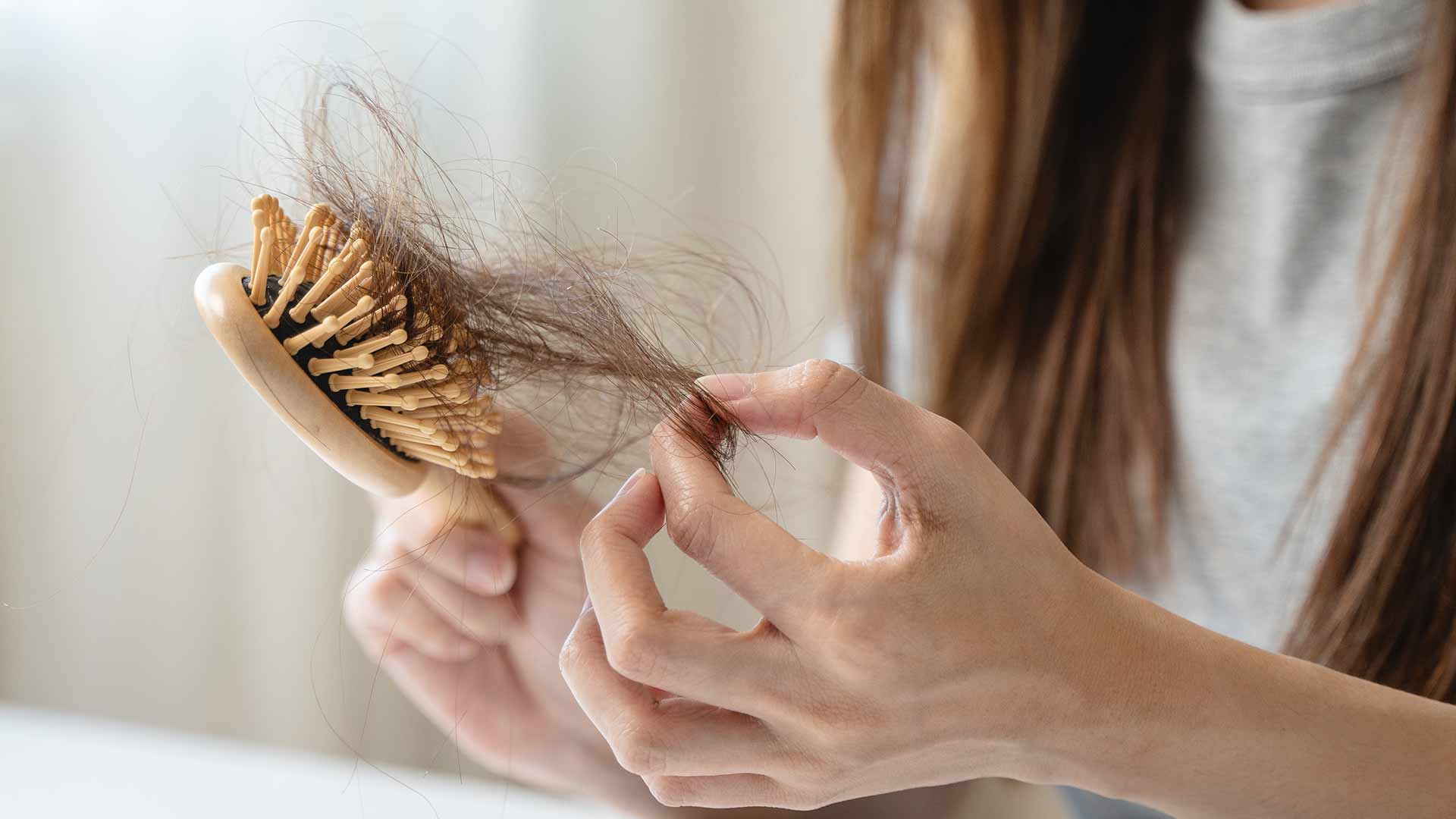 Dermapen-Hair-Loss-Treatment-monaz-clinic