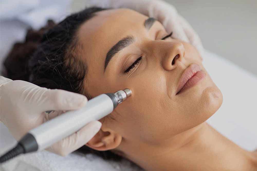 Dermapen treatment Monaz Clinic London