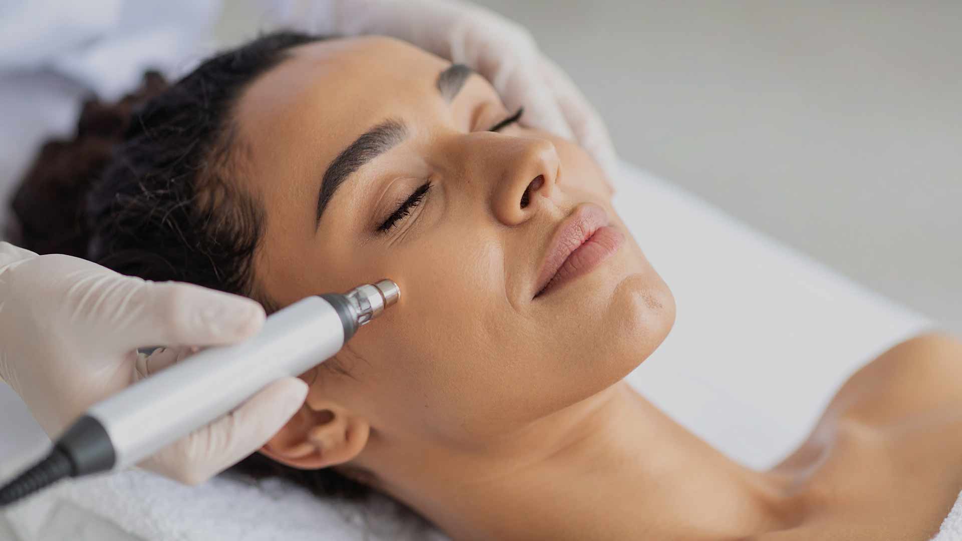 Dermapen-treatment-monaz-clinic