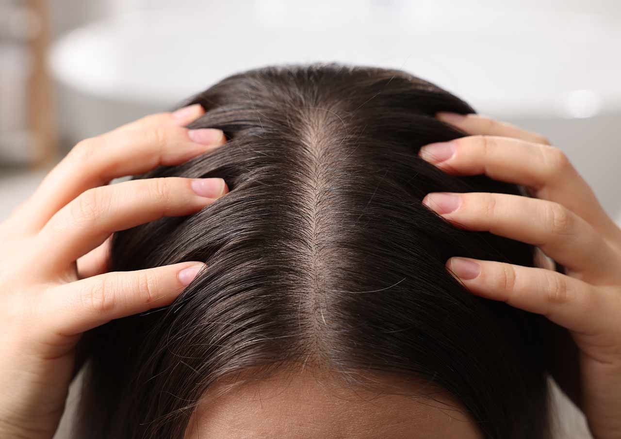 Dermapen + Exosome Treatment for Hair and Scalp Rejuvenation 1 Looking to Restore Healthier Fuller Hair Naturally and Without Surgery