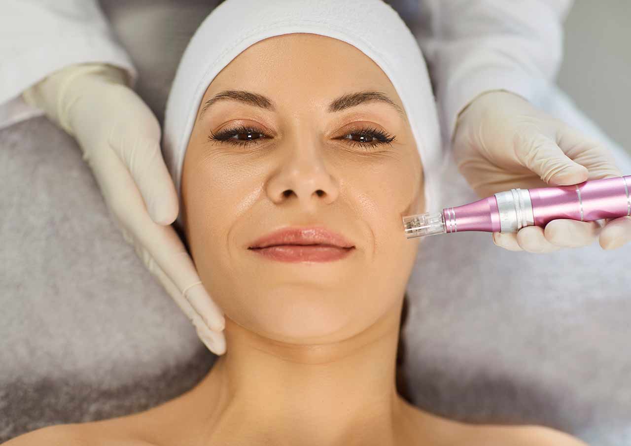 Dermapen Anti-Ageing Treatment 2 Why Choose Dermapen for Anti Ageing at Monaz Clinic
