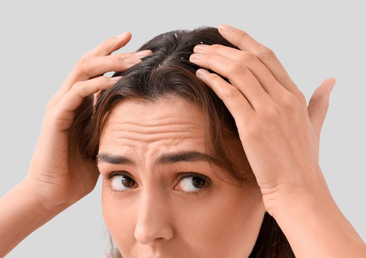 Why Choose Dermapen for Hair Loss Alopecia