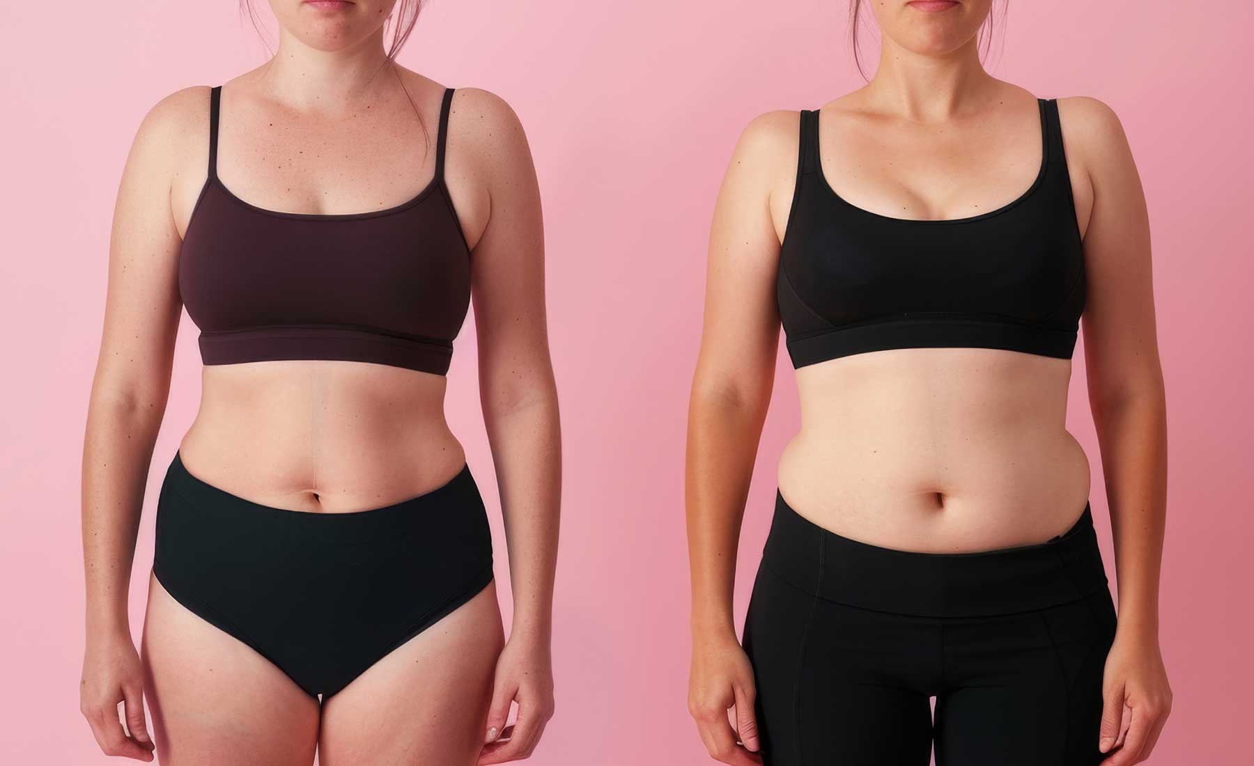 Flanks (Love Handle) Fat Dissolving with AQUALYX 3 AQUALYX-fat-dissolving-treatment-before-and-after-1