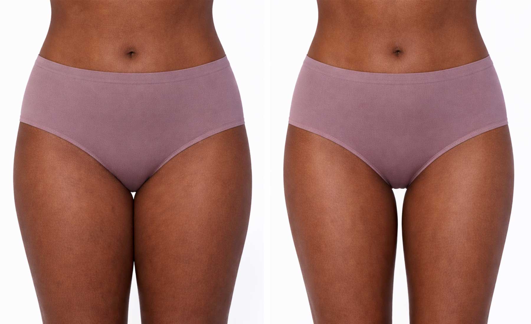 Inner-Thigh-Fat-Dissolving-before-and-after-1