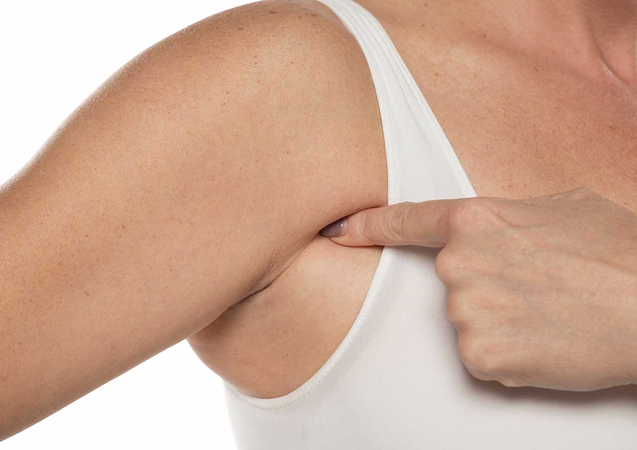 Looking-to-Reduce-Underarm-Fat-Without-Surgery-at-Monaz-Clinic