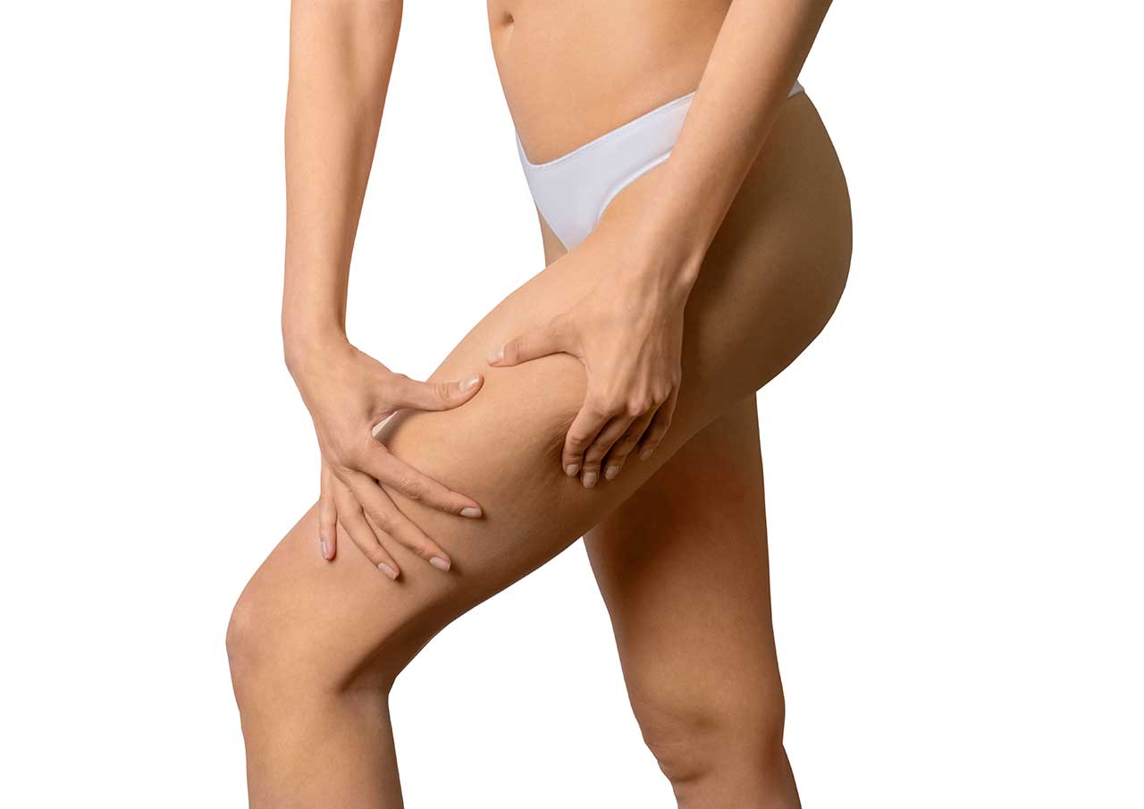 Outer Thigh Fat Dissolving with AQUALYX 2 What-Is-Outer-Thigh-Fat-Dissolving
