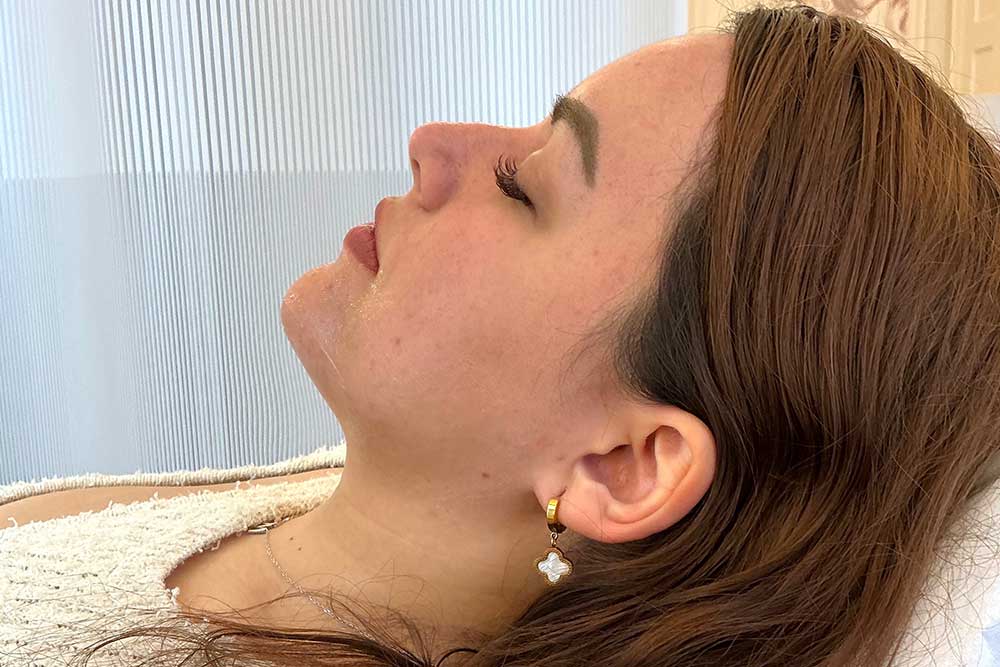 Aqualyx Fat Dissolving Treatment at Monaz Clinic